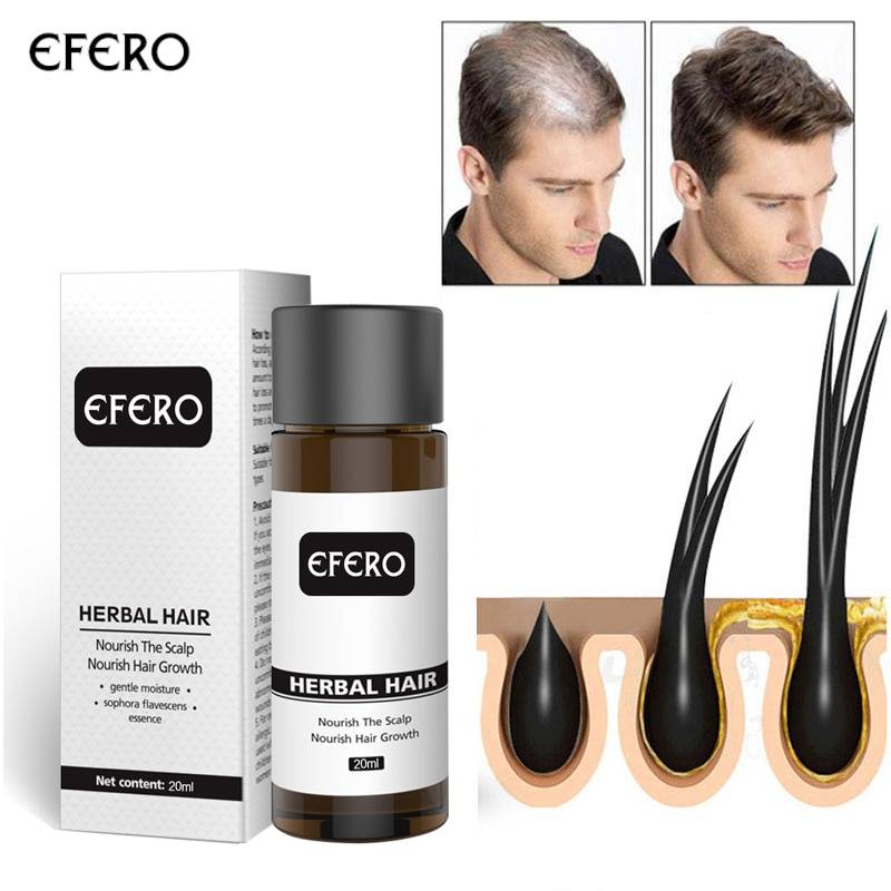 Ginger Hair Growth Essential Oil Serum Hair Treatment Hair Care Hats & Hair Accessories Health Care Number of Pieces: One Unit