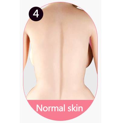 Normal Skin